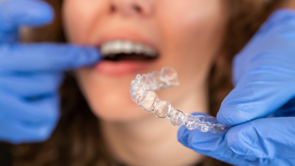 Orthodontist removing clear aligners