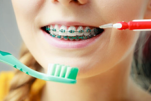 a patient with braces brushing their teeth 